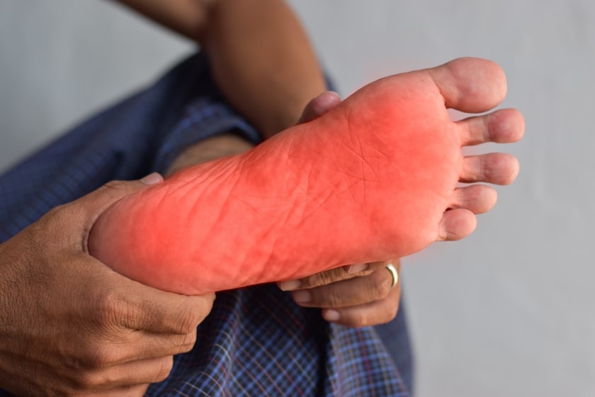 diabetic neuropathy